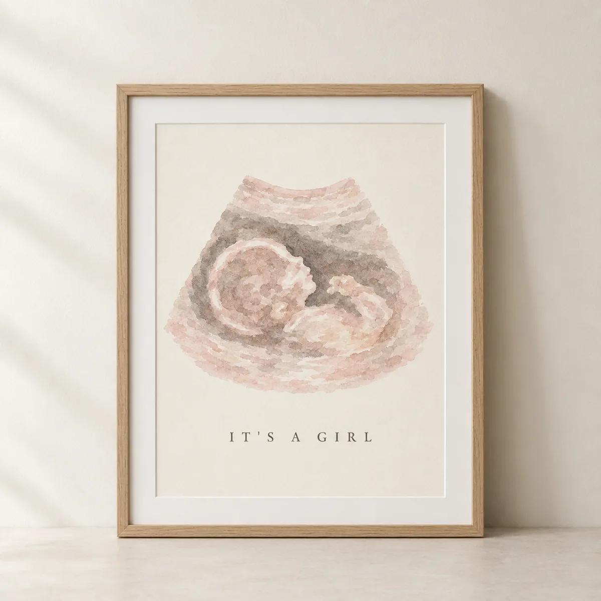The same scan as a framed watercolour print reading It's a girl
