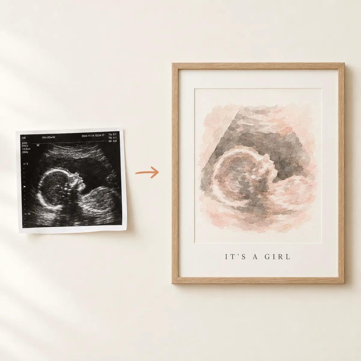 A clinic ultrasound printout beside the same scan framed as watercolour art reading It's a girl